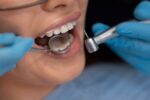 A woman is receiving dental crowns on her teeth.
