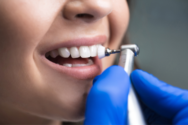a lady is getting teeth whitening treatment