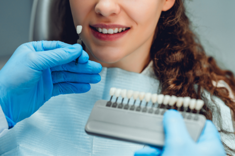 a lady is visiting dental clinic for tooth colour fillings